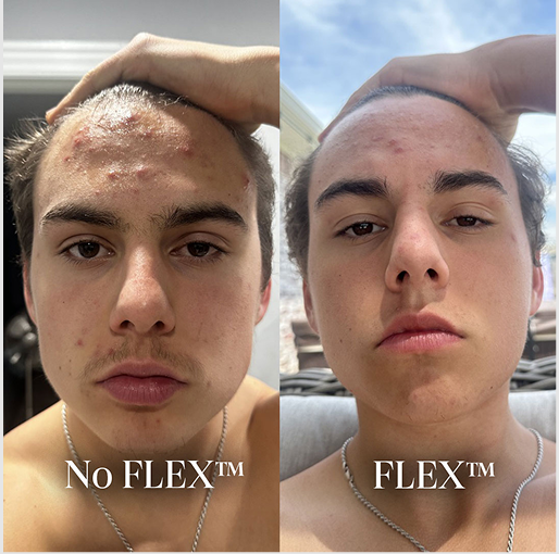 Douxds FLEX Review: Is This Vibrating Face Brush Actually Worth It for Men? 7 Flex Face Brush Before After