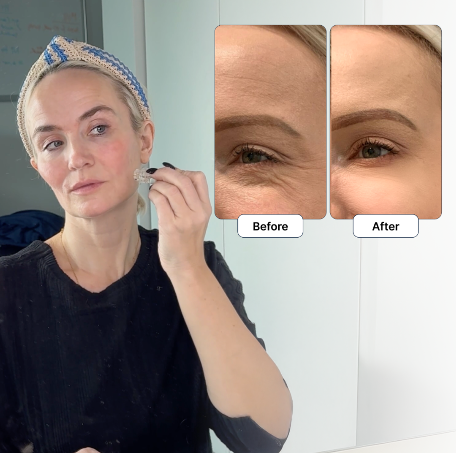 Glamory Review 2026: Does the Micro-Infusion System Actually Work? 5 Glamory Before After