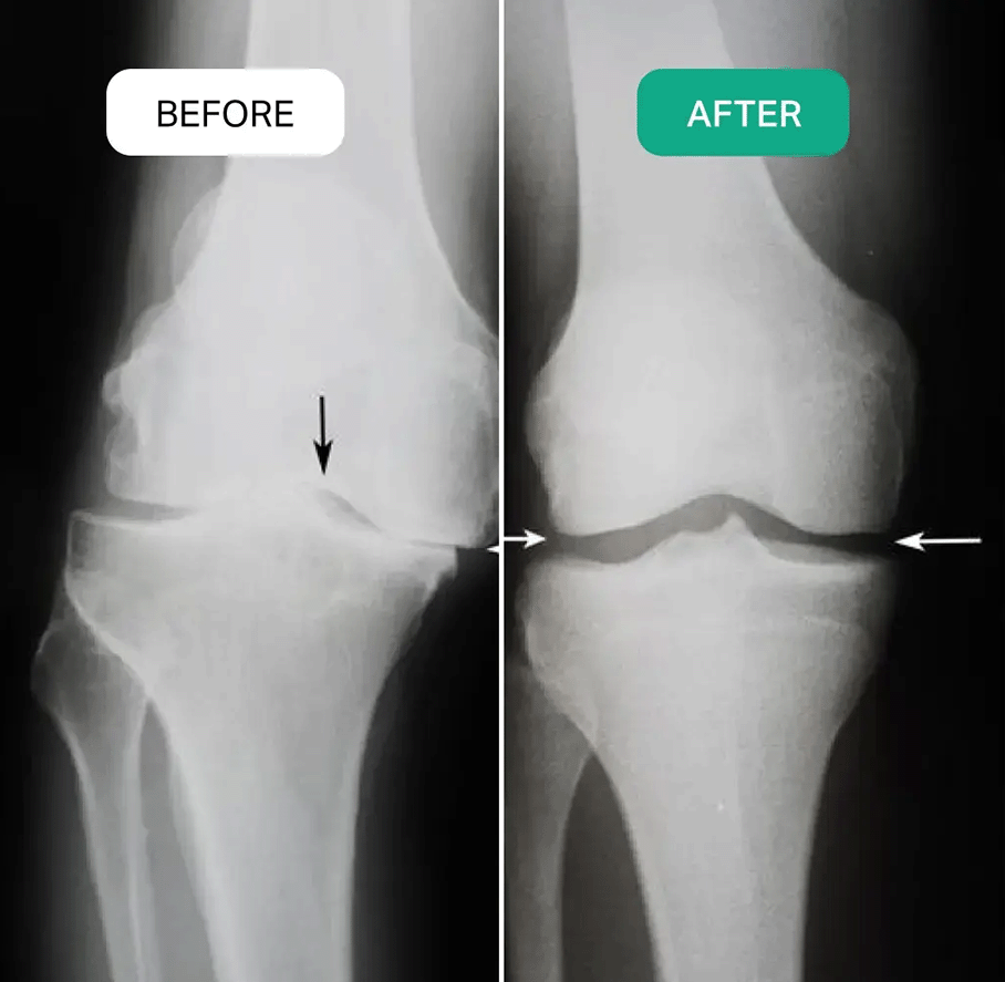 Rejuvaknee Benefits