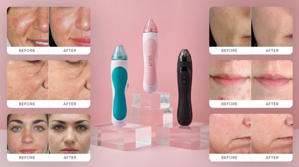 The Ultimate PMD Microderm Review (2026): Real Results, Safety Warnings & Alternatives 1 PMD Microderm Review