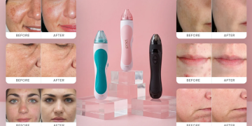 PMD Microderm Review