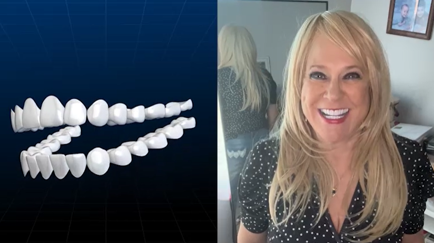 Shiny Smile Veneers Review 2026: Does This Home Cosmetic Solution for Covering Stains, Gaps, and Missing Teeth Actually Work? 3 Shiny Smile Veneers Benefits