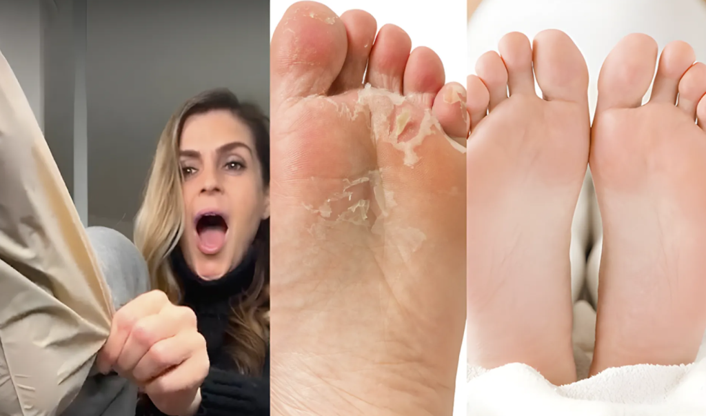 Foot Peel Mask Review 2026: My Honest Experience & Best Picks 3 Foot Peel Mask